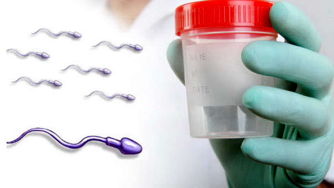Sperm antibodies treatment