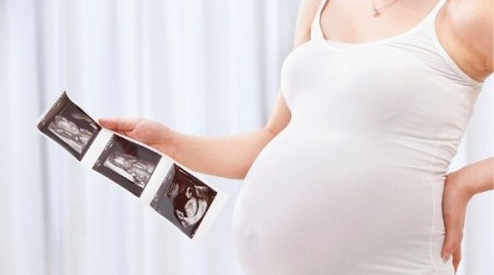 Что покажет УЗИ на 30 неделе беременности?