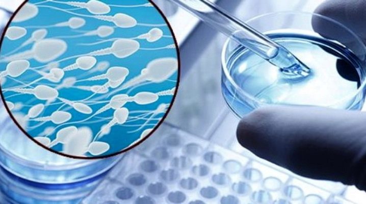Спермограмма по Крюгеру: тонкости проведения и расшифровка результатов