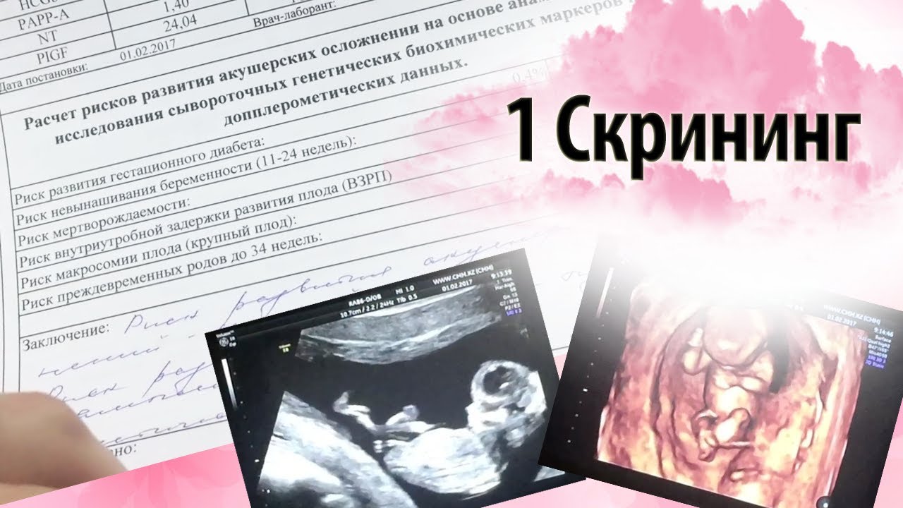 Можно узнать пол на 12 неделе беременности. УЗИ скрининг. УЗИ 12 недель. УЗИ 12-13 недель беременности. УЗИ 11-12 недель беременности.