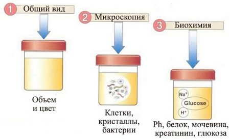 Как сдать мочу без белка при беременности