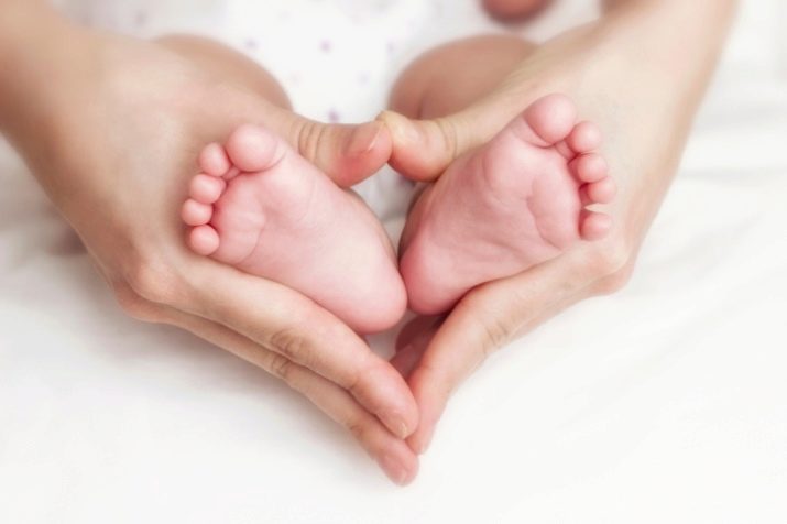 Синдром пяточных стоп у новорожденных фото